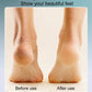 🔥Hot Sale💕Rechargeable Electric Foot Callus Remover