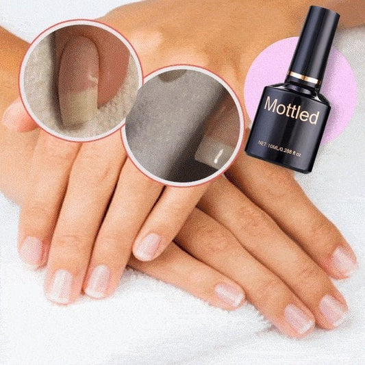💥 49% OFF🎁  2025 Nail Repair Protection Gel