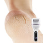 Portable Electric Foot Callus Remover